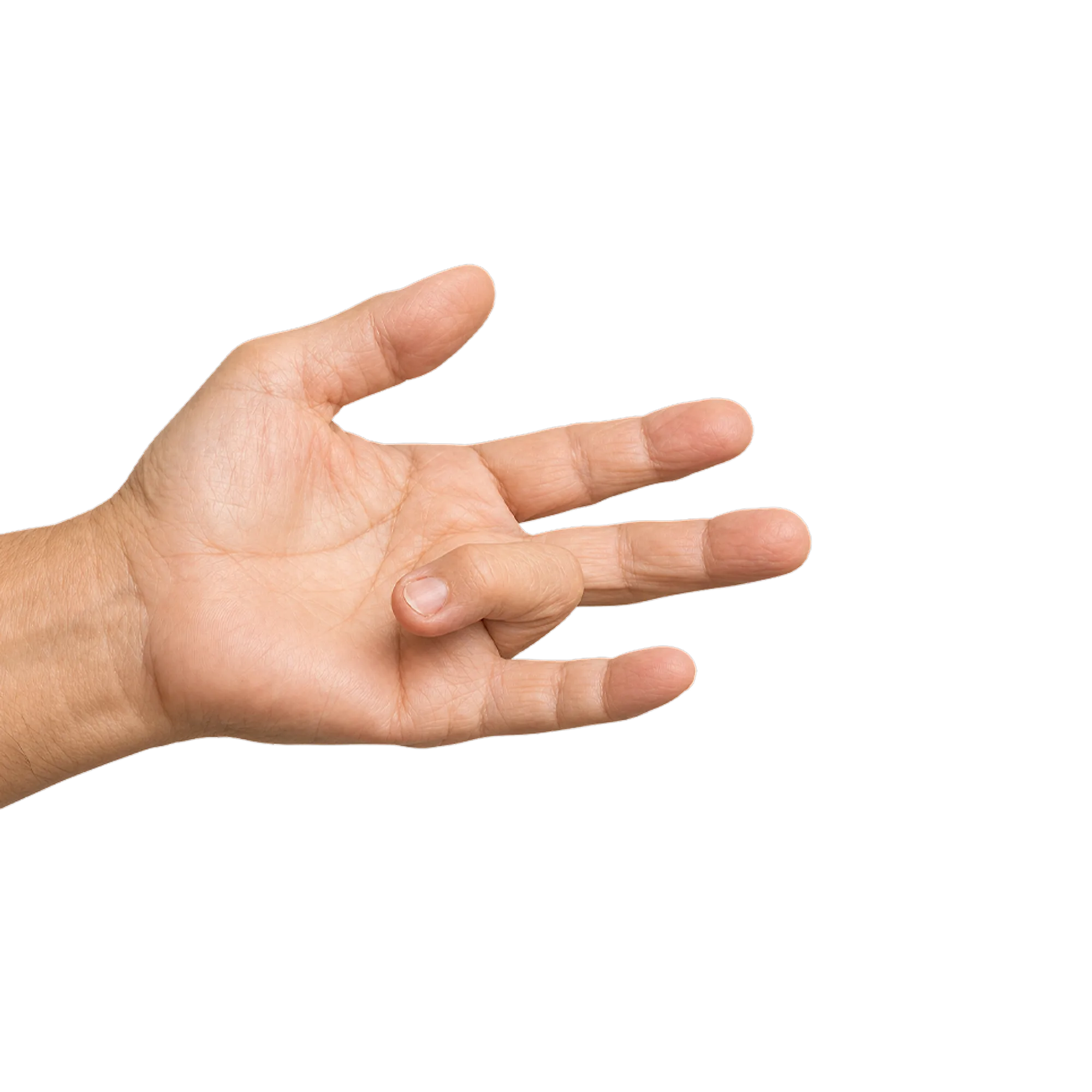 Schnappfinger-Behandlung in der Praxisklinik Bayreuth